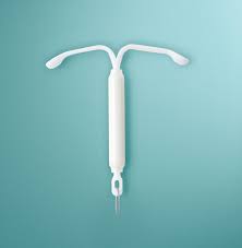 Mirena 52 MG (LVN) Dispositivo Intrauterino CJX1 BAYER